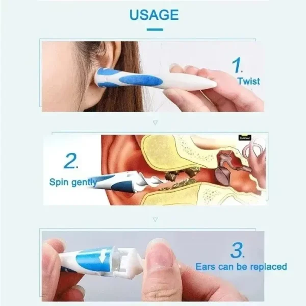 Strumento per la rimozione del cerume Detergente per le orecchie con silicone morbido 16 punte di ricambio semplicemente per afferrare l'estratto del cerume 2